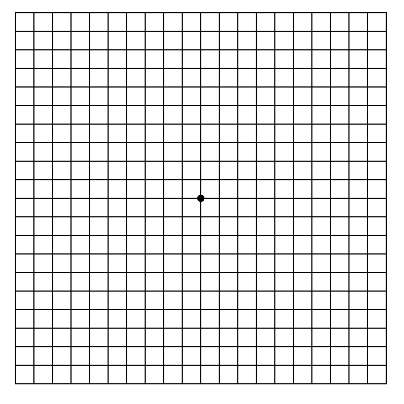 Amsler grid test pattern