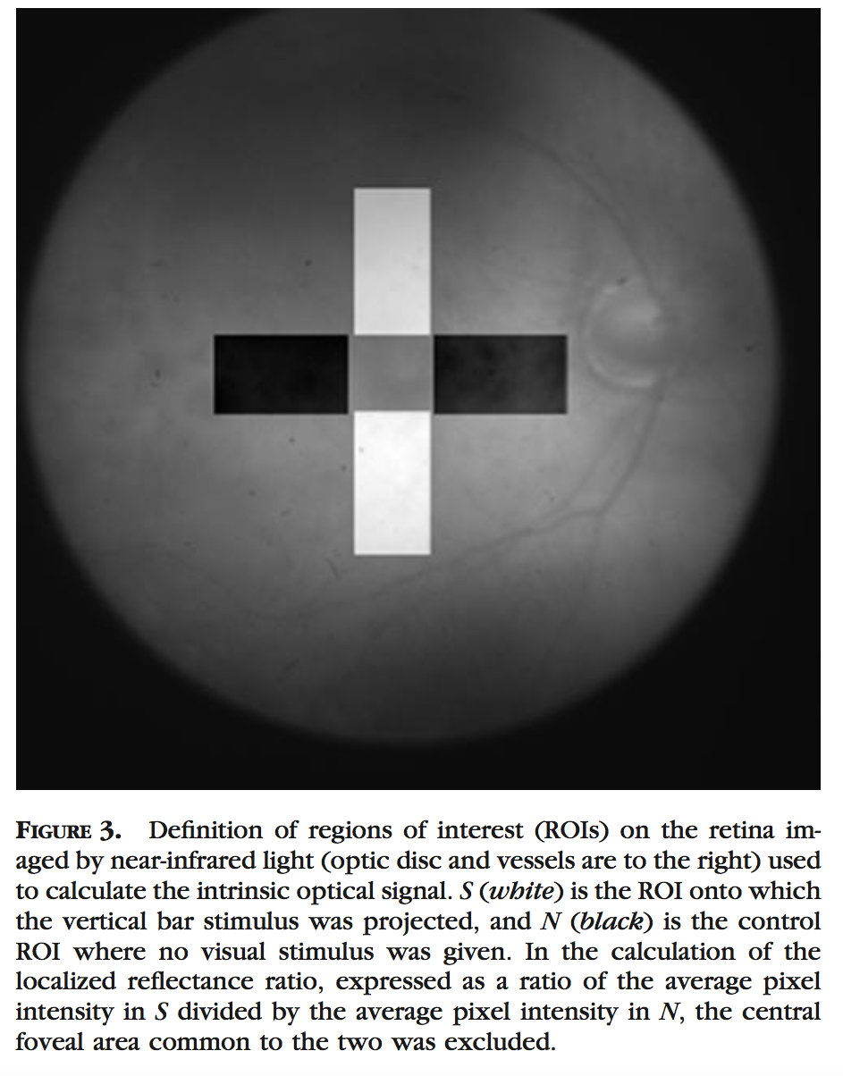 Figure 3 from Abramoff '06